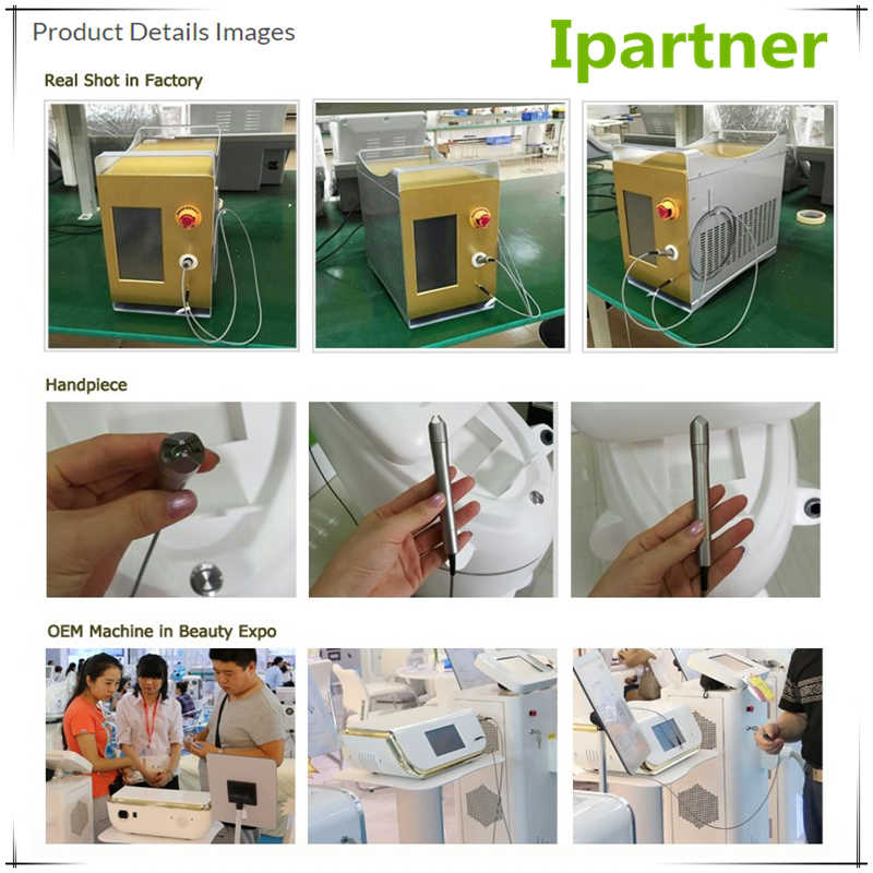 Ipartner LS980 Faigheann an Córas Sásaimh ó Dhé-óid Laser