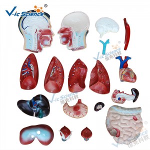 Anatamaíocht Leighis Samhail an Duine 85CM Múnla Torso Fireann 19 Páirteanna